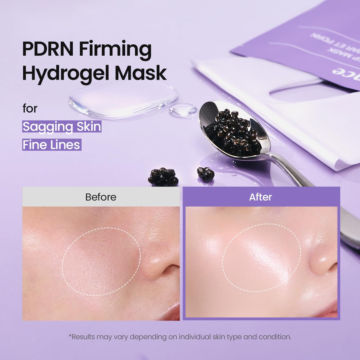 BIODANCE Pack x 4  Mascarilla profunda PDRN de caviar rejuvenecedor, mascarilla facial de hidroge