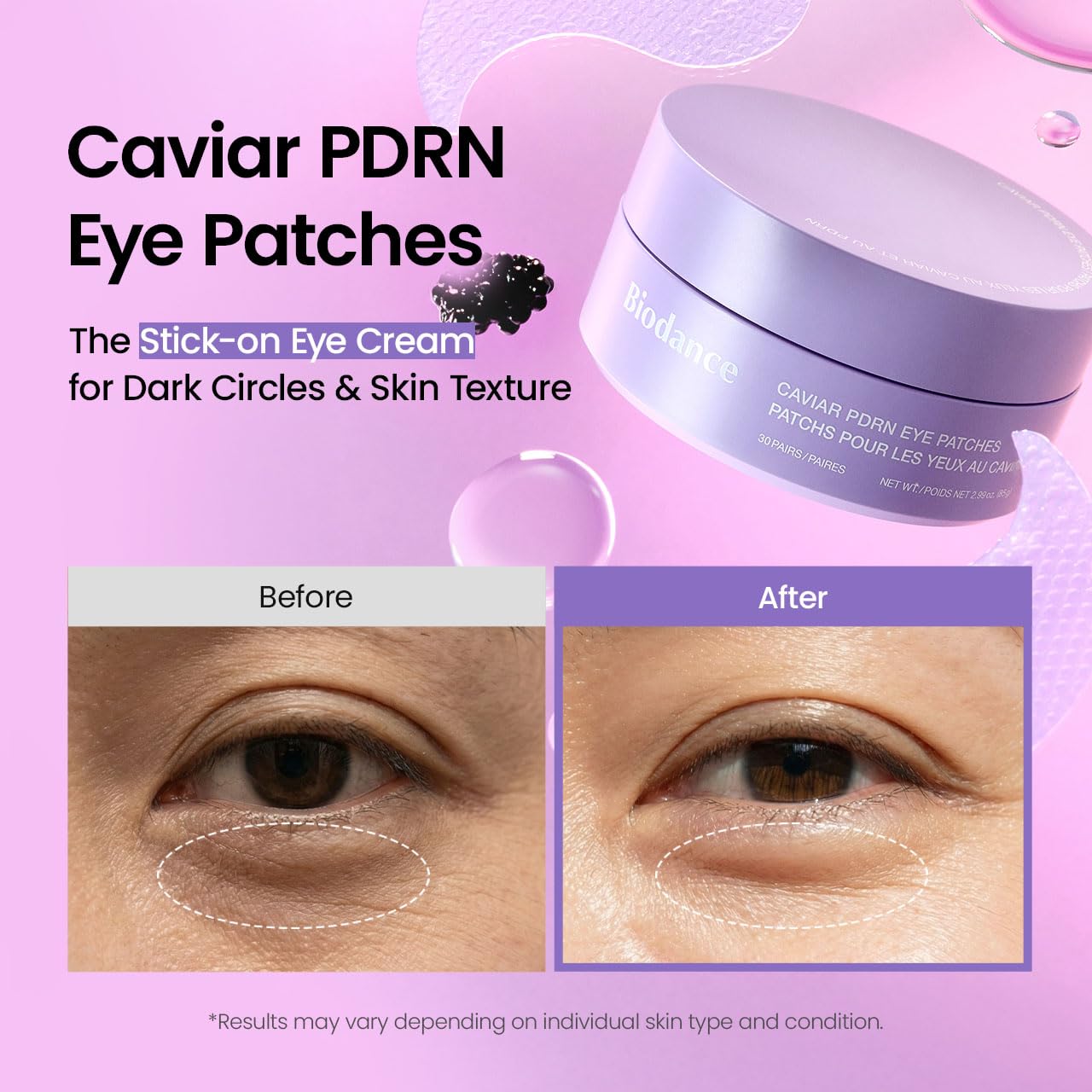 BIODANCE Caviar PDRN - Parches Ojeras Hidrogel Caviar Pdrn Exosomas ,  antiinflamación ojos hinchados y cansados 60 UNIDADES
