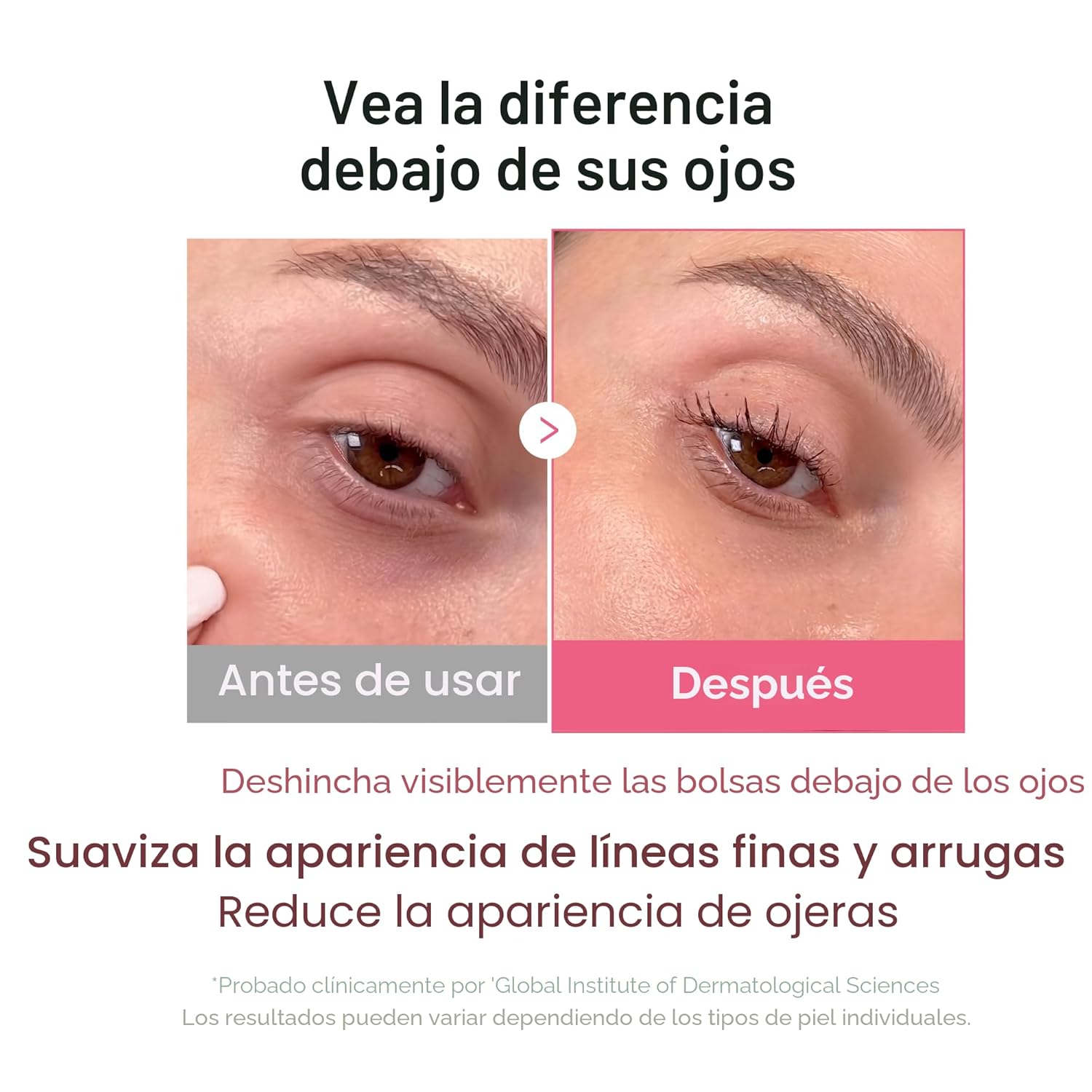 Medicube PDRN - Máscara de ojos de gelatina de colágeno rosa | Parches de hidrogel para ojos con PDRN, colágeno, NAD