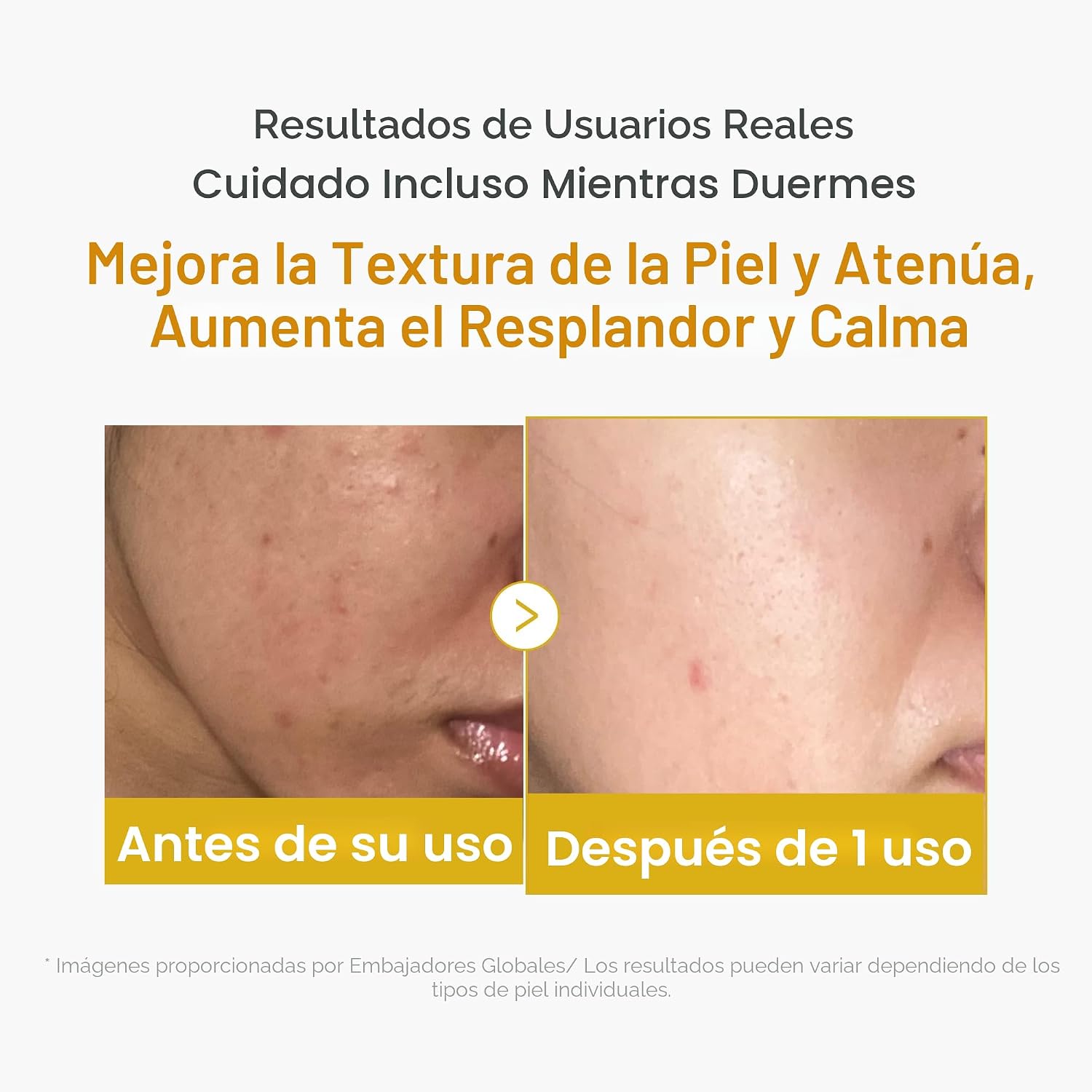 Medicube Máscara de envoltura de ácido kójico, cúrcuma, vitamina C durante la noche