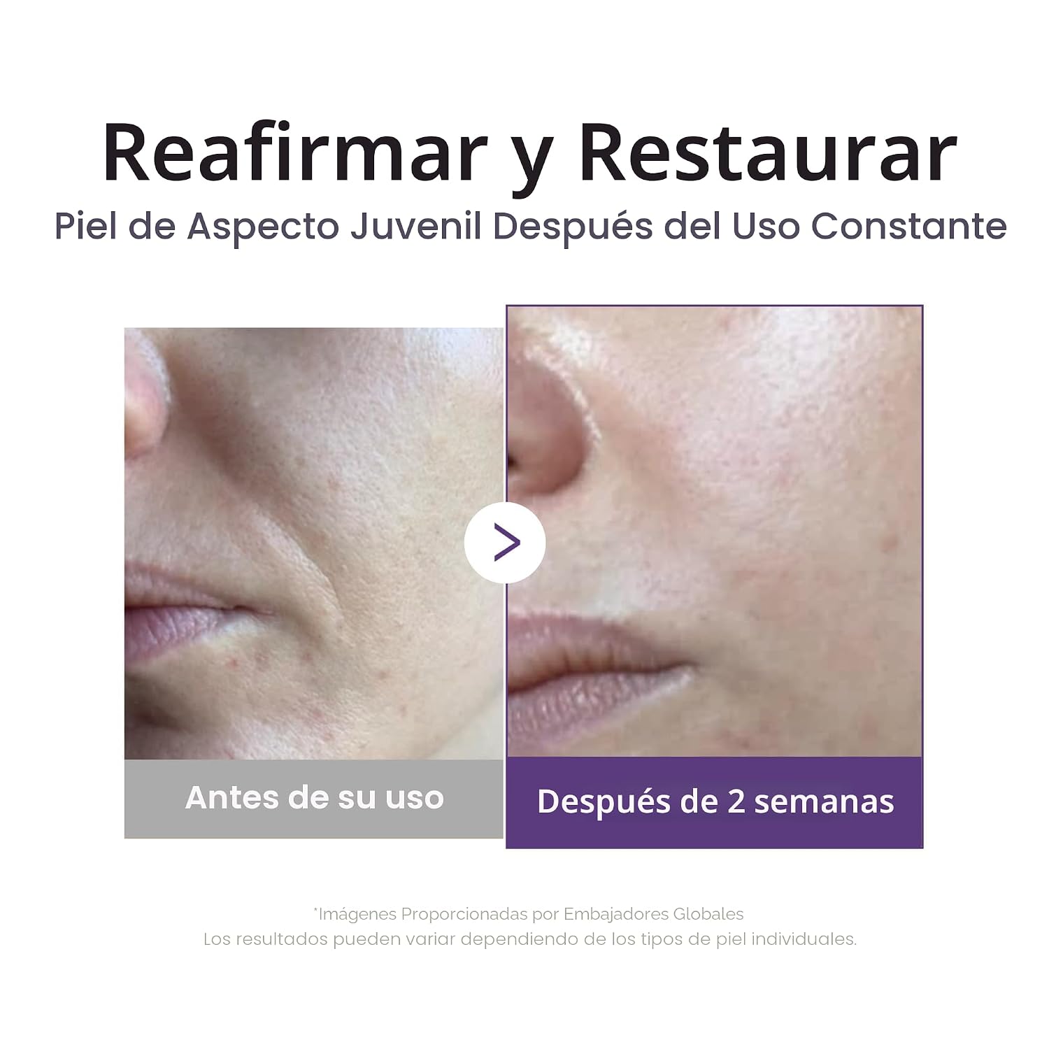 Medicube Suero potenciador de retinol , hidratación y relleno con retinol, péptidos y vitaminas