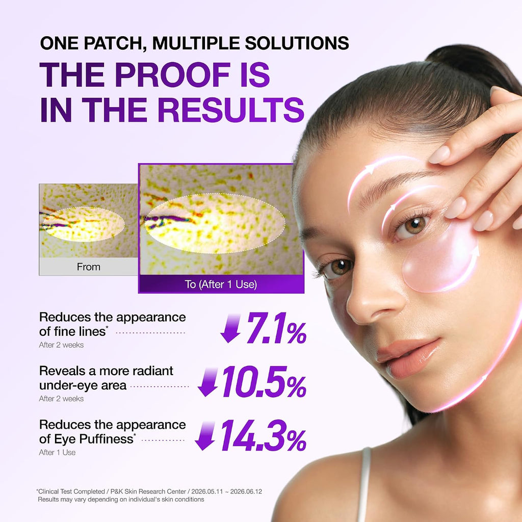 ANUA Retinol Berry Eye Patches, 60 unidades | Máscara de hidrogel para ojos hinchados, ojeras y líneas finas, niacinamida de cafeína, cuidado de la piel coreano