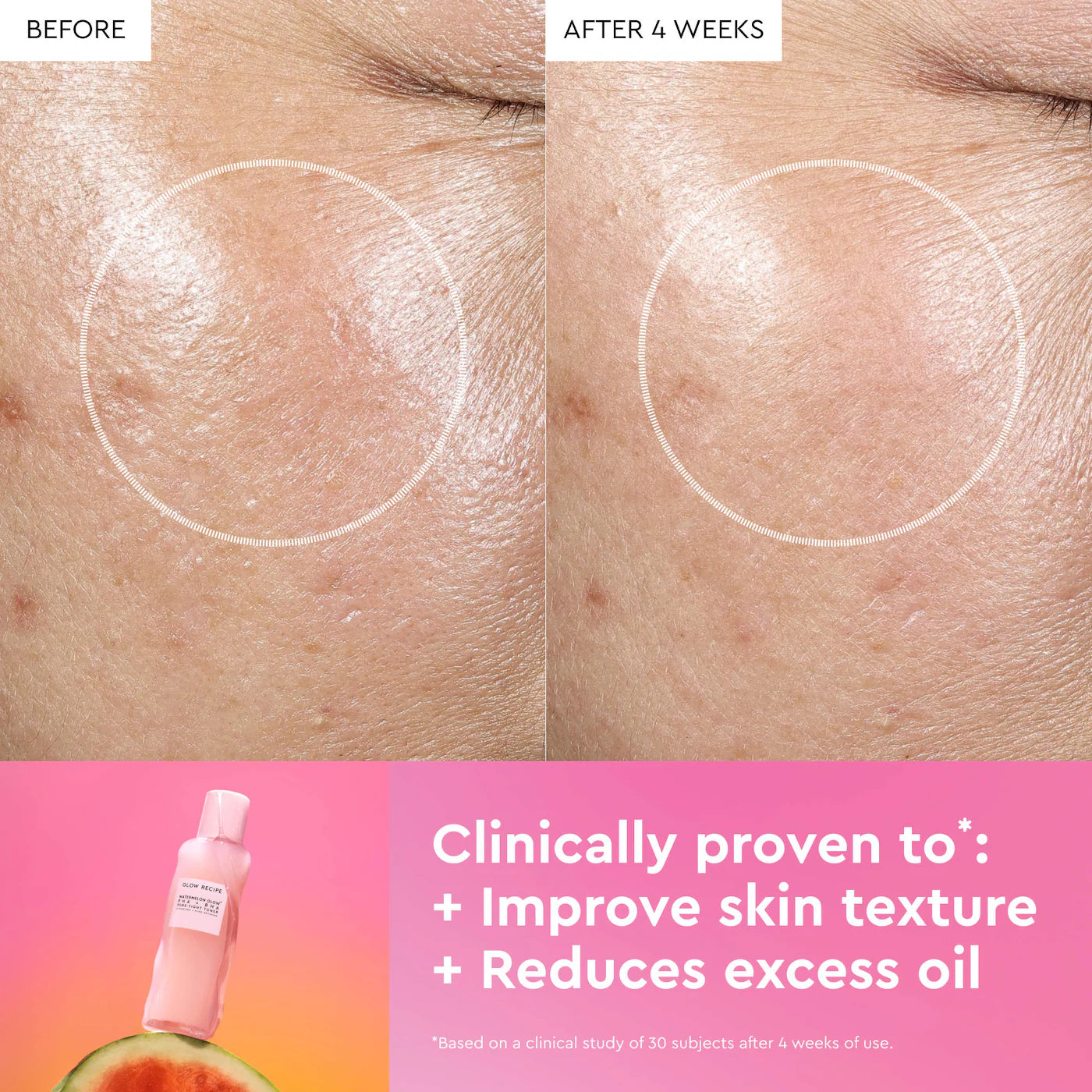 Glow Recipe  Tonico - Watermelon Glow PHA + BHA Pore-Tight Toner