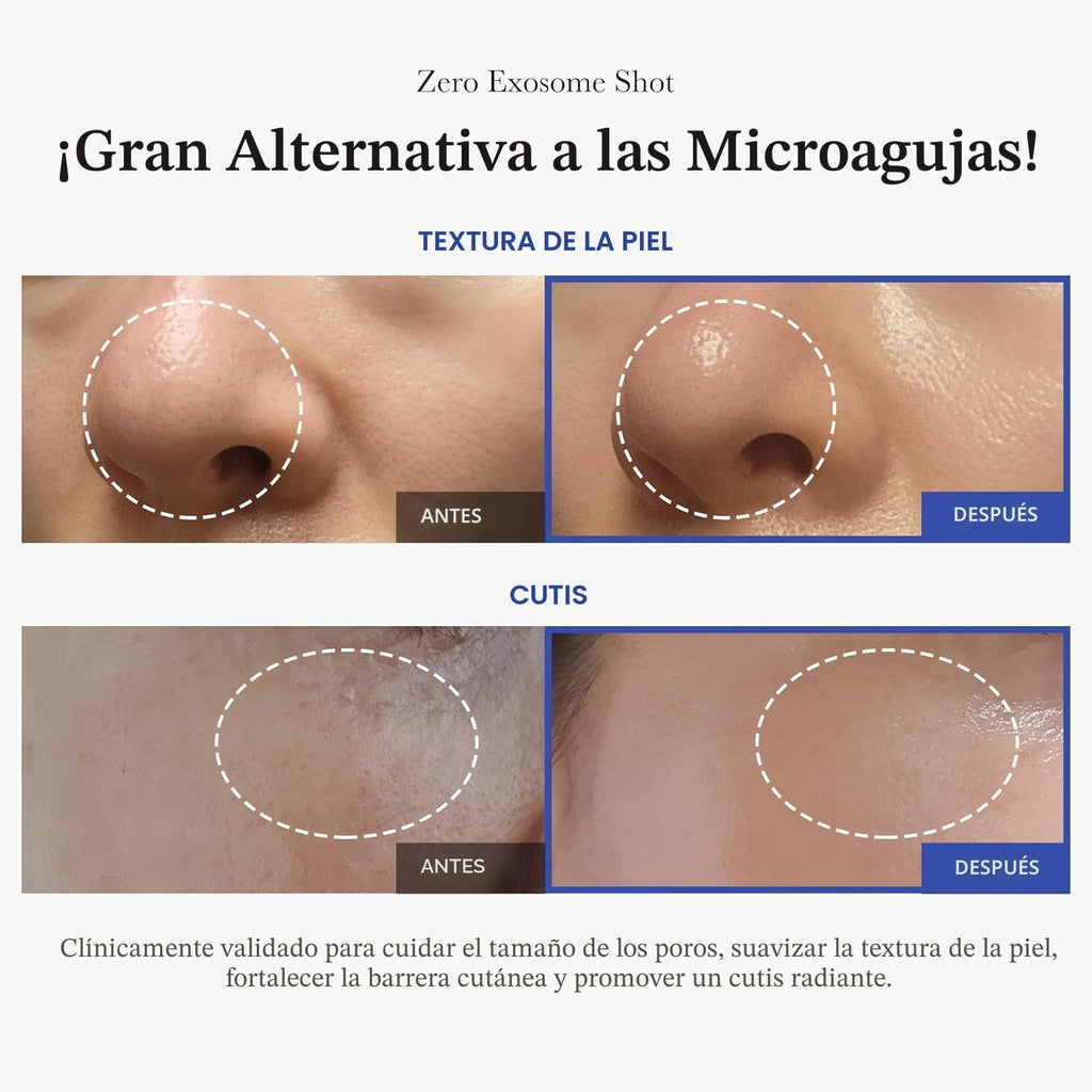 Medicube Zero Exosome Shot 7,000  PPM