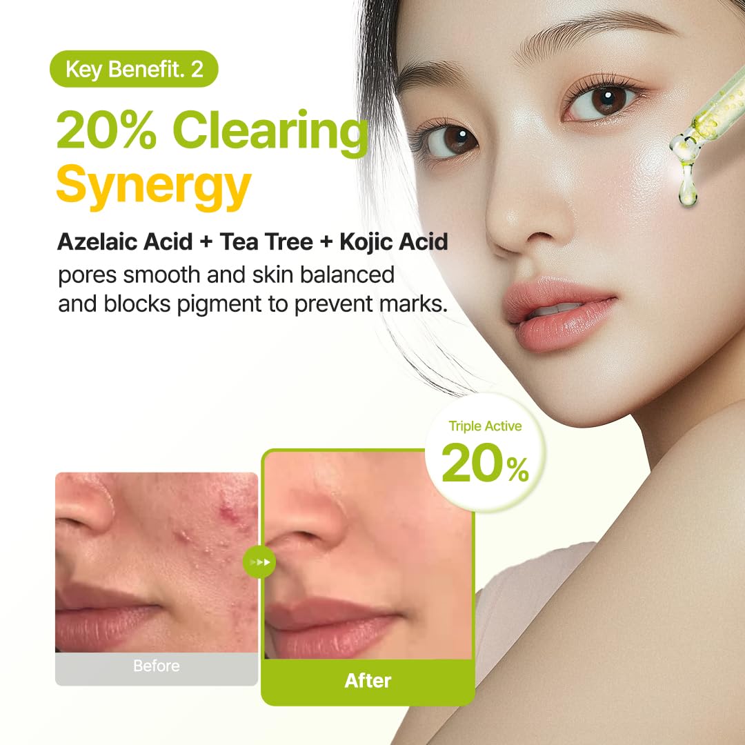 PURITO Ácido Azelaico 10% + Ácido Kójico + Suero Facial de Árbol de Té | para Acné y Marcas, Brotes